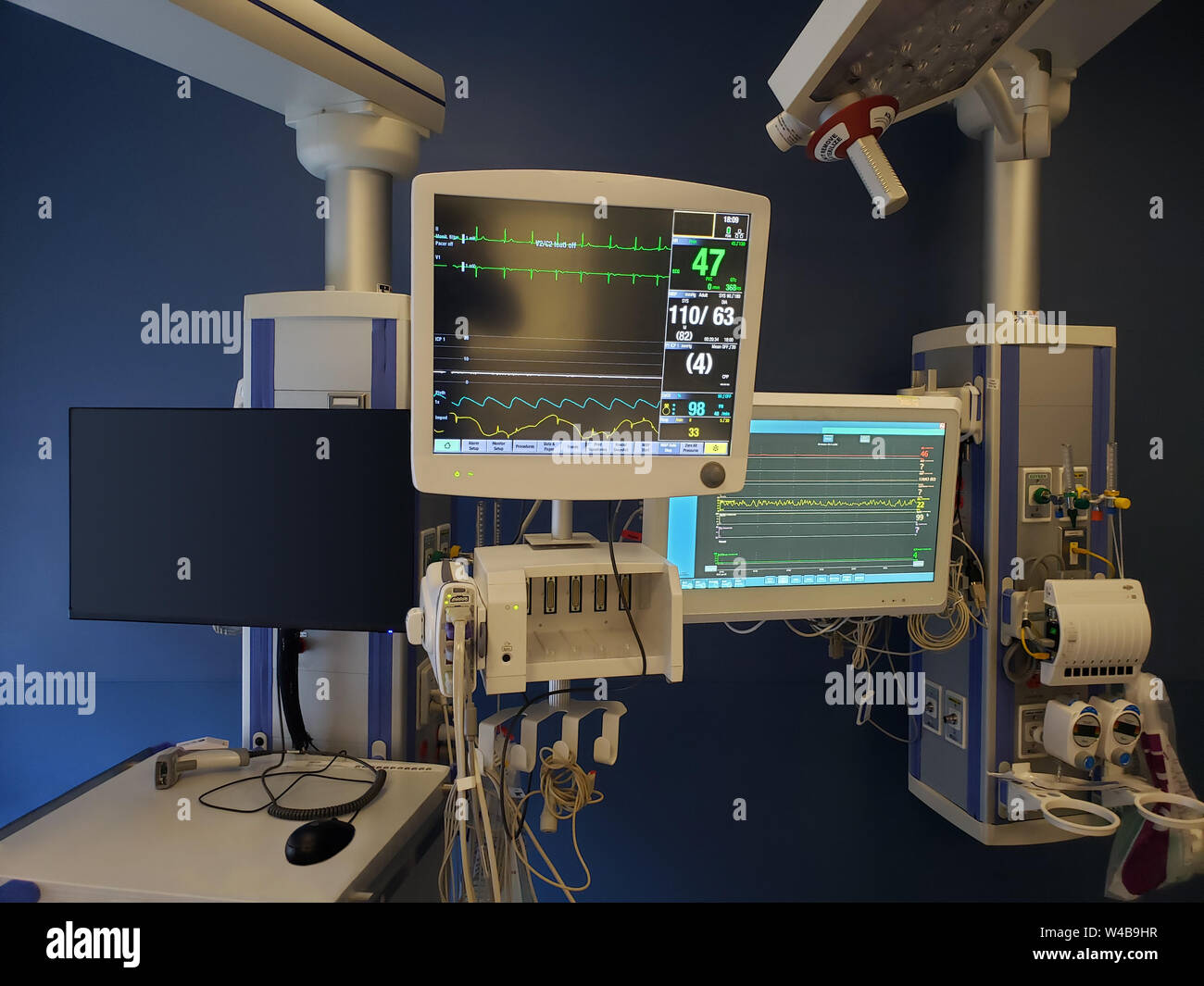 Advanced monitoring equipment in a modern Intensive Care Unit Stock Photo