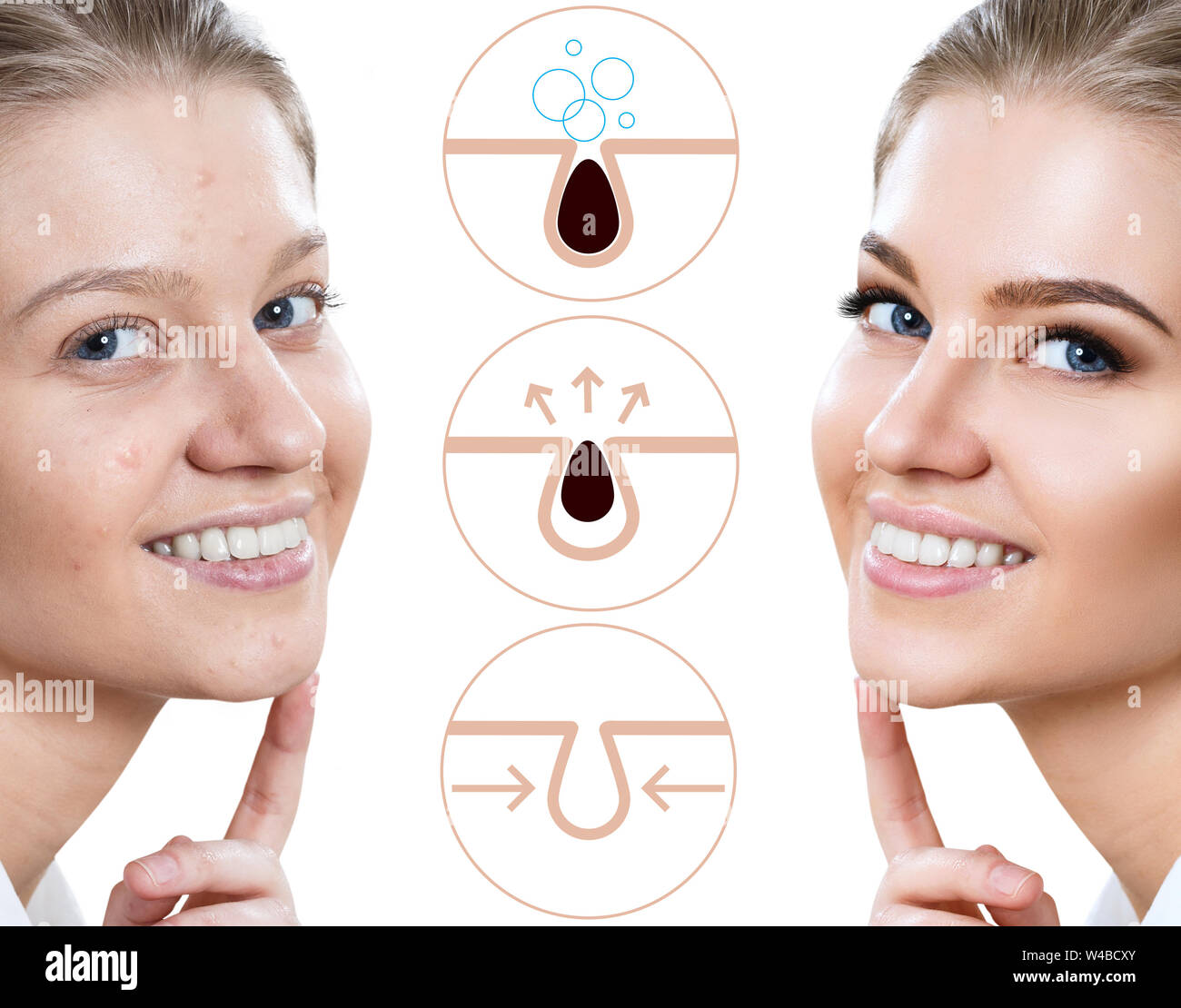 Graphically shows how to pollute and clean the pores on face. Stock Photo