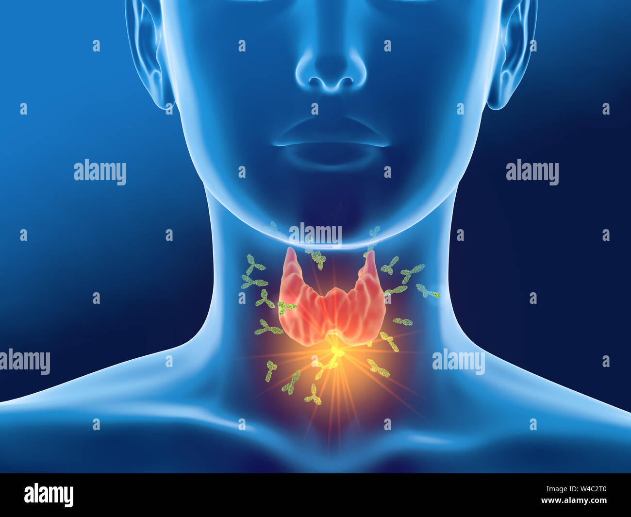 Medically 3D illustration showing antibodies attacking thyroid gland of a woman Stock Photo Alamy