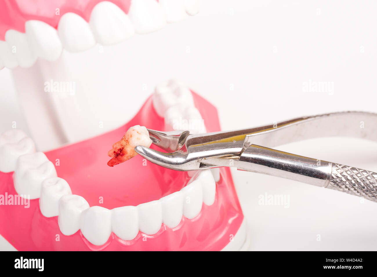 Dental tools and remove tooth at clinic isolated on white Stock Photo Alamy