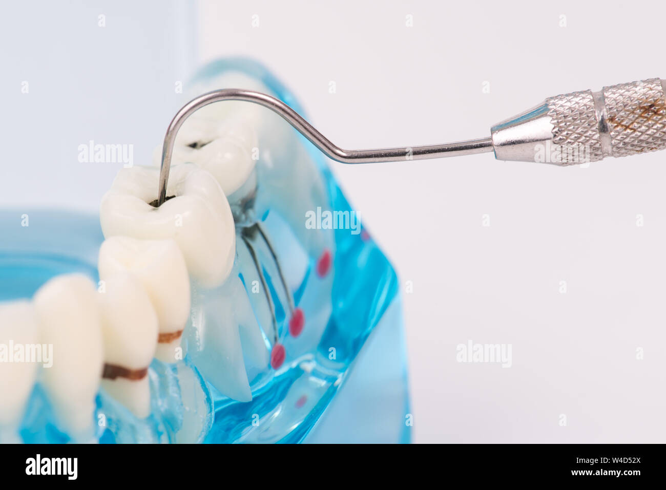close up dental or tooth model with dental tool Stock Photo Alamy