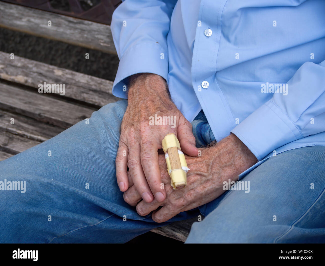 Bone fracture first aid hi-res stock photography and images - Alamy