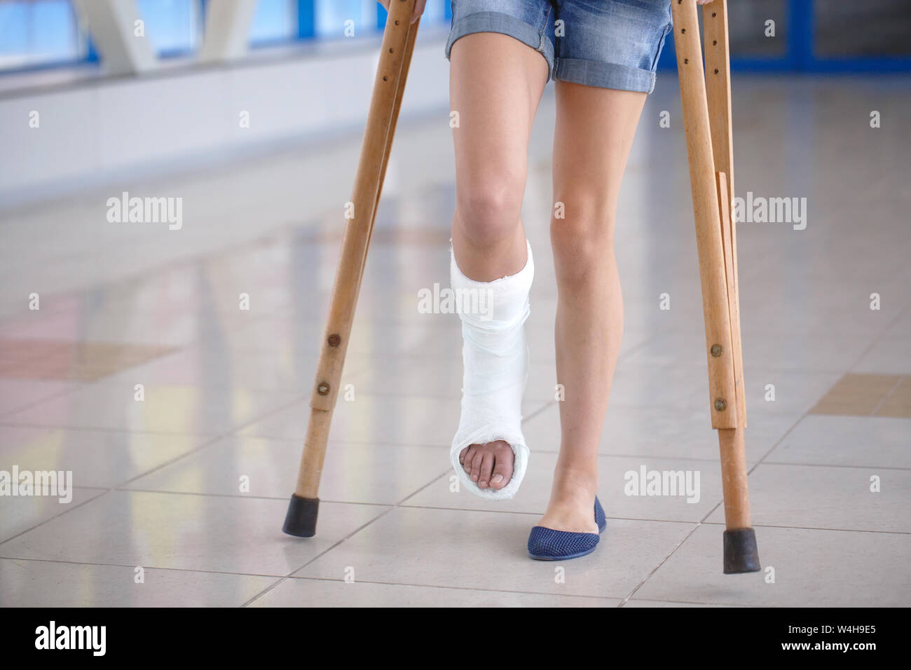 A young girl is on crutches in the corridor of the hospital Stock Photo Alamy