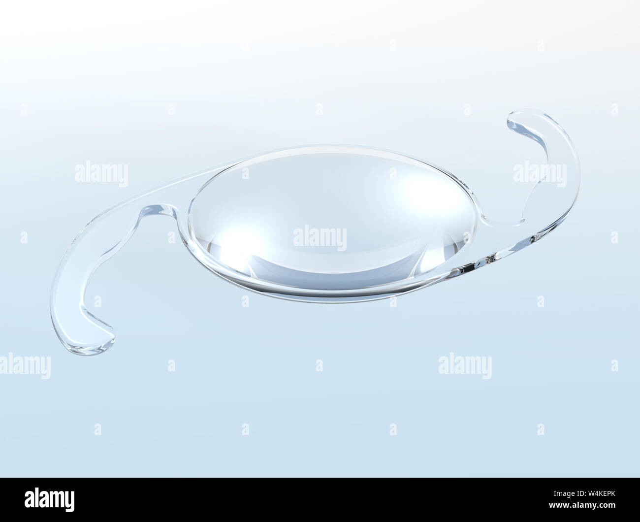 Medically 3D illustration showing intraocular lens (IOL), a lens implanted in the eye as part of a treatment for cataracts or myopia Stock Photo