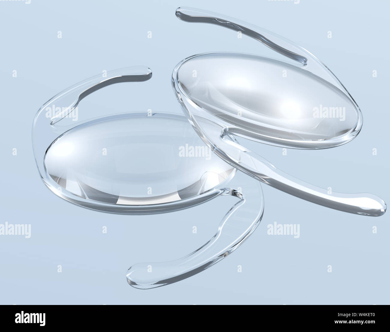 Medically illustration showing intraocular lens (IOL), a lens implanted in the eye as part of a treatment for cataracts or myopia, 3D illustration Stock Photo