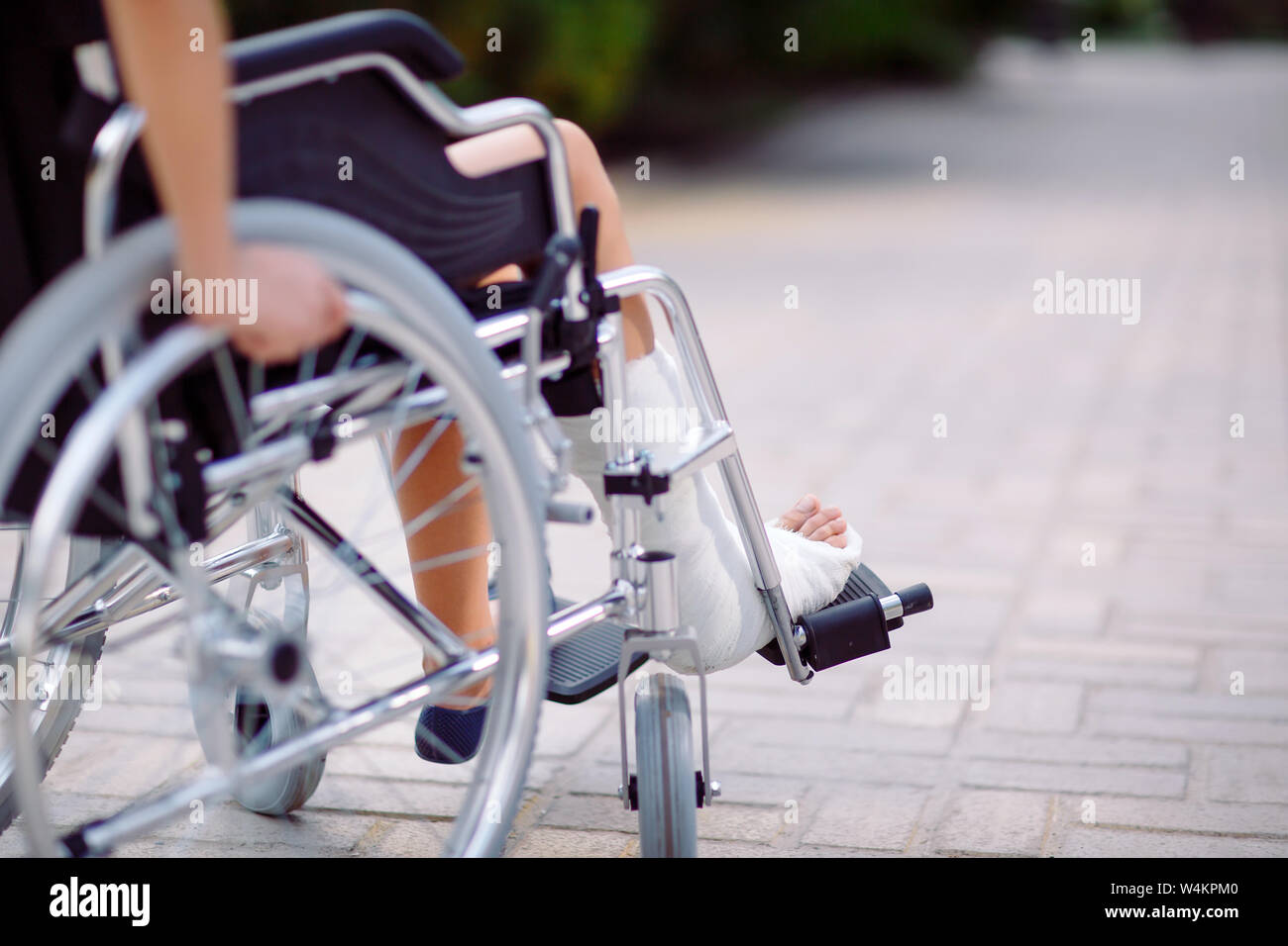 A girl with a broken leg sits in a wheelchair Stock Photo Alamy