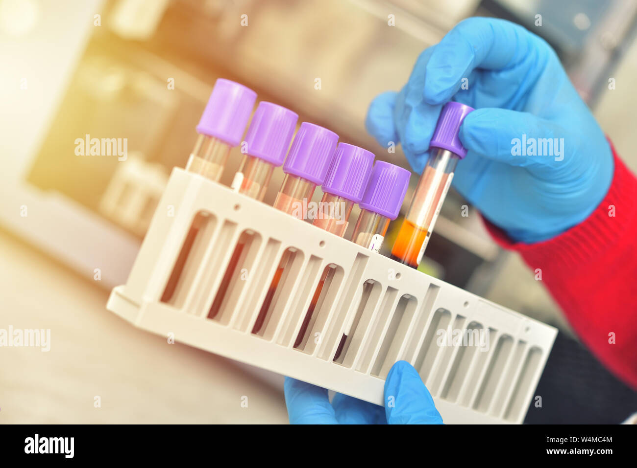 Tubes of blood sample for testing. Medical equipment Stock Photo Alamy