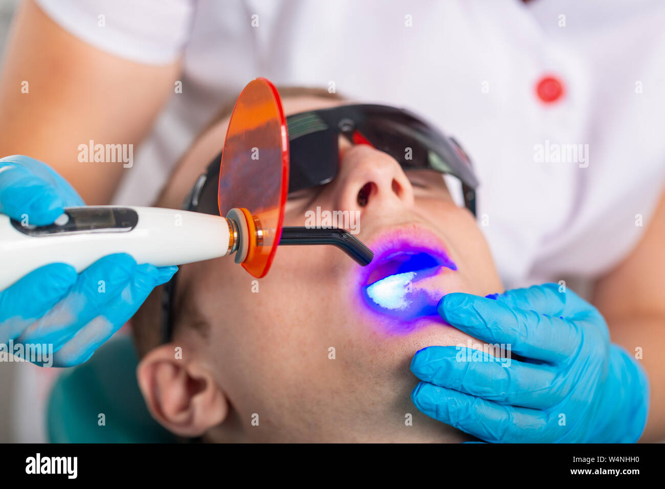 Closeup portrait of a male patient at dentist in the clinic. Teeth