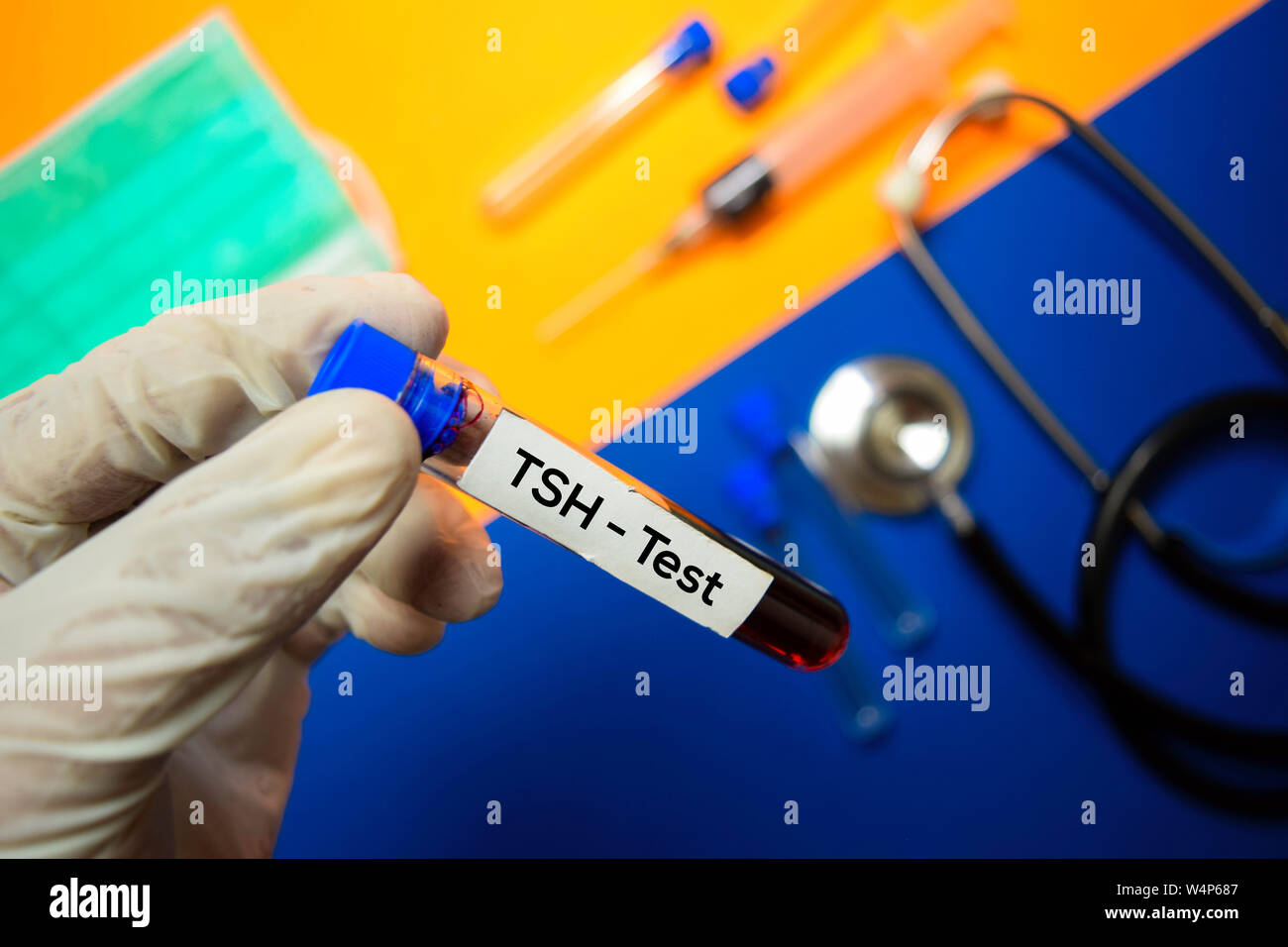 TSH Test with blood sample. Top view isolated on color background