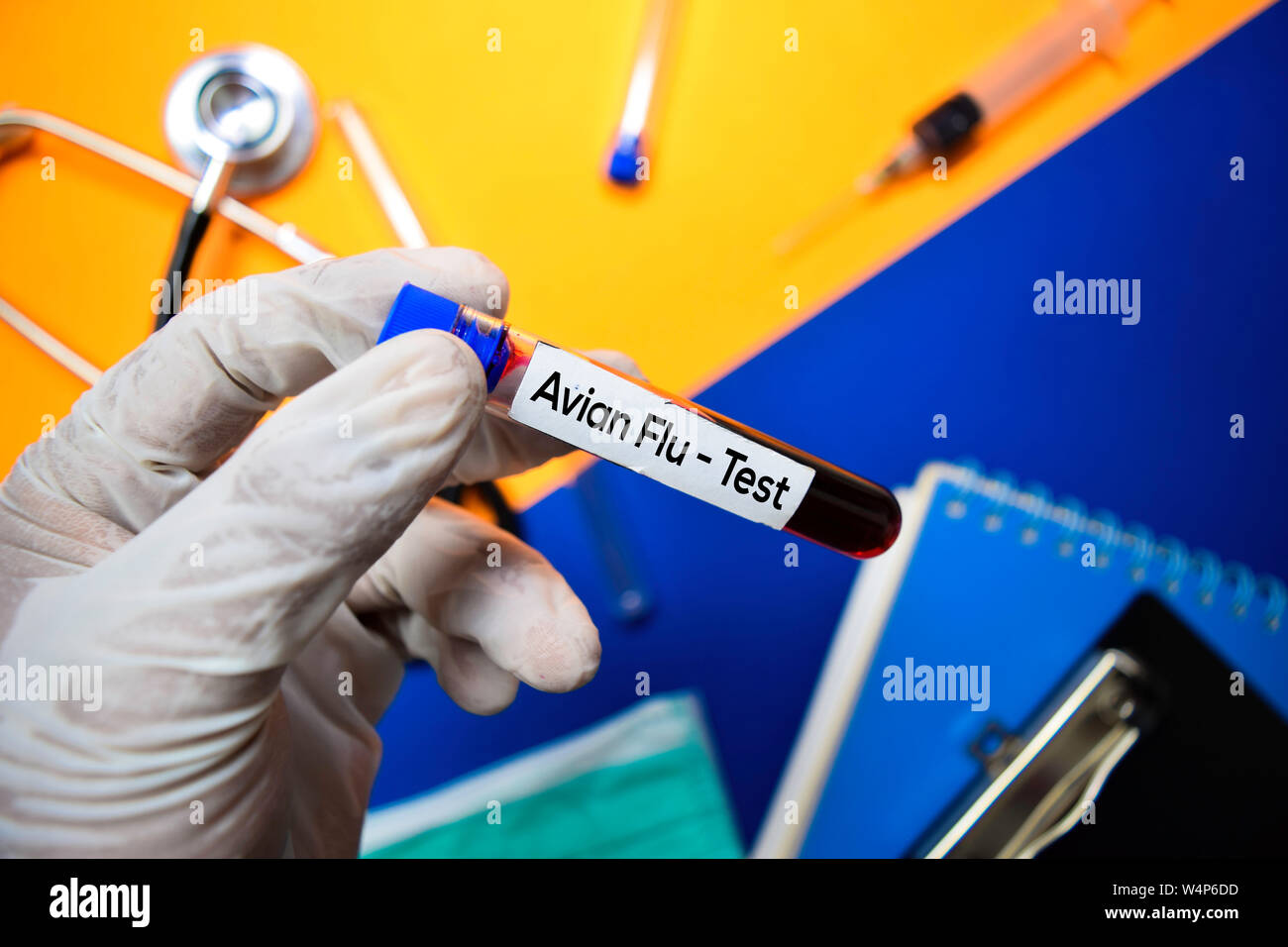 Avian Flu Test with blood sample. Top view isolated on color