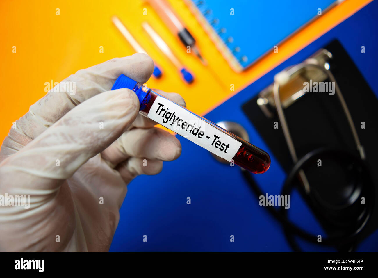 Triglyceride Test with blood sample. Top view isolated on color background. Healthcare/Medical