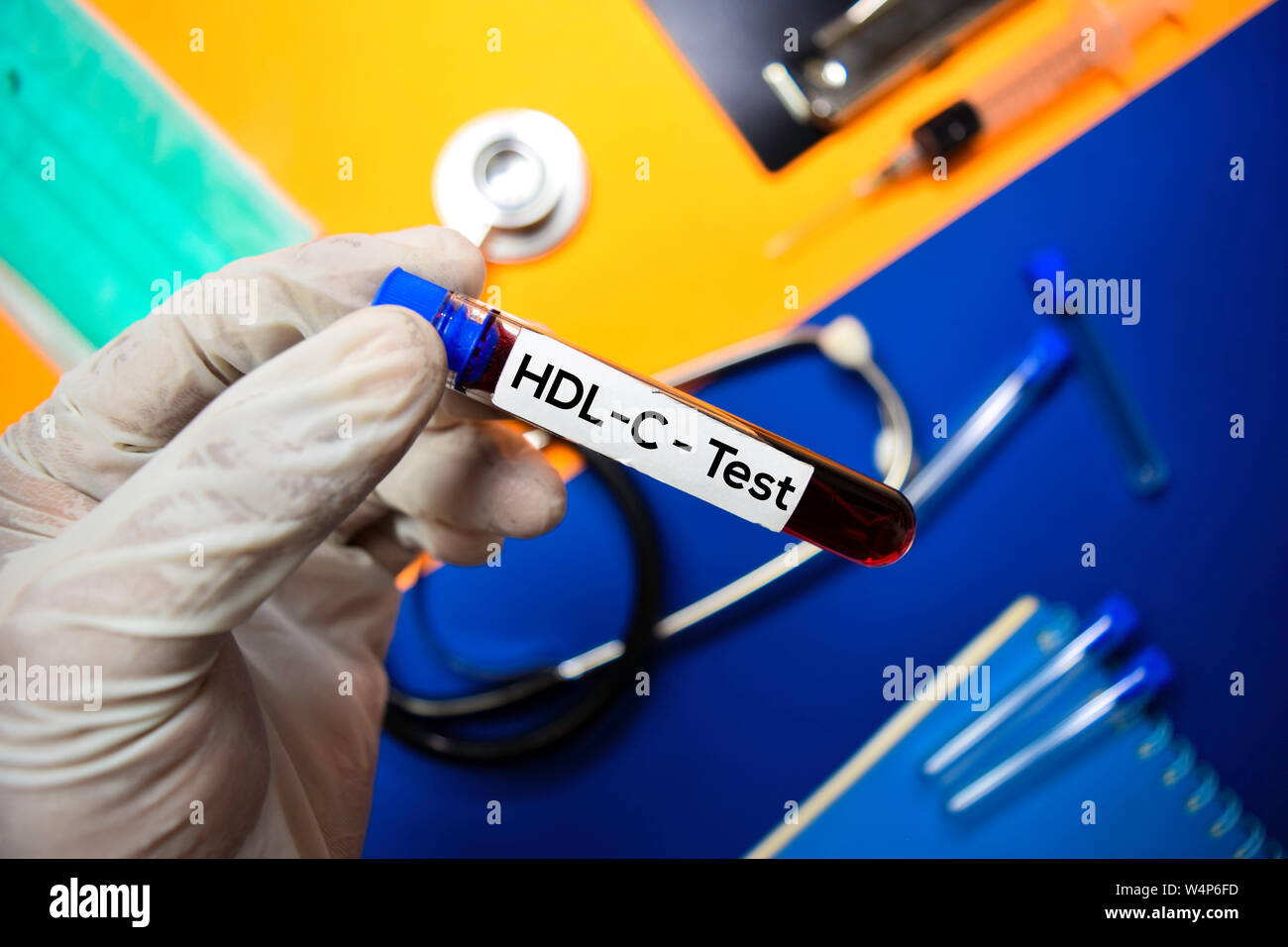 HDLC Test with blood sample. Top view isolated on color background