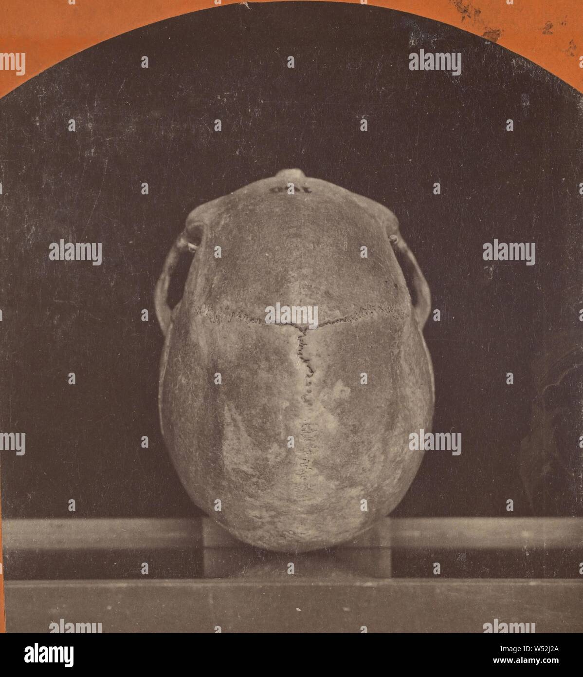Vertical View of a Cranium. From an ancient tumulus near Fort Wadsworth, Dakota Territory., Unknown maker, American, about 1870, Albumen silver print Stock Photo