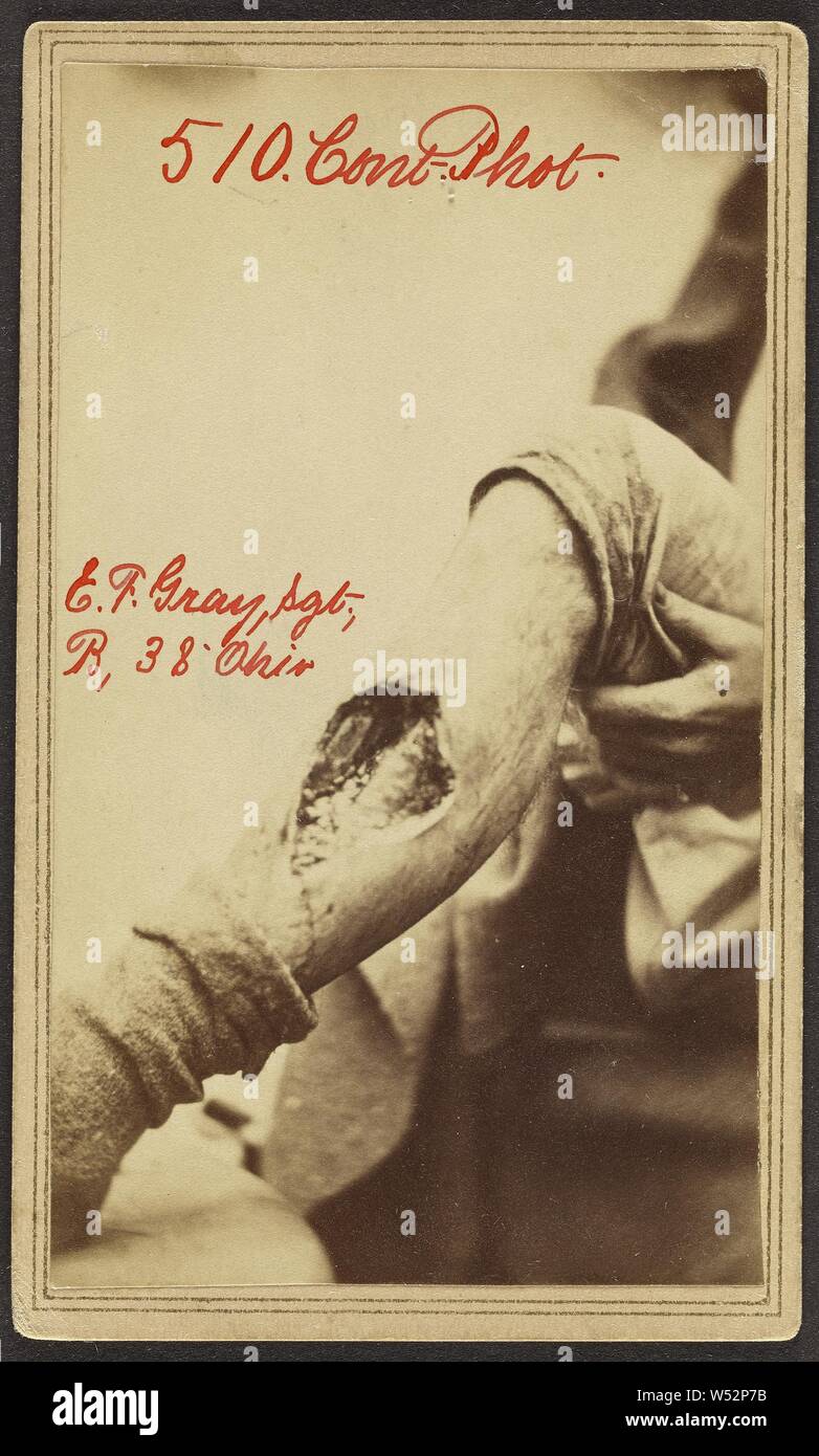 Edward F Gray Sergt Co B 38 Ohio Civil War Victim Attributed To William H Bell American 10 1910 United States 1864 Albumen Silver Print 9 4 5 5 Cm 3 11 16 2 3 16 In Stock Photo Alamy