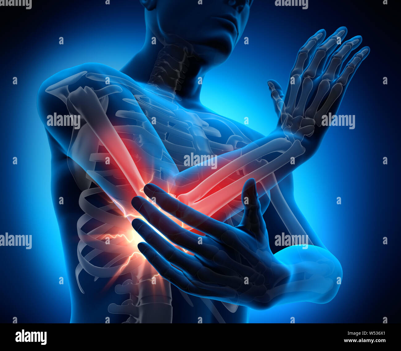 Forearm bones hires stock photography and images Alamy