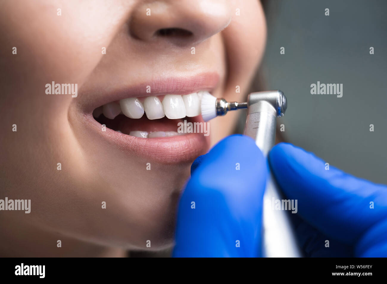Professional dental cleaning hires stock photography and images Alamy