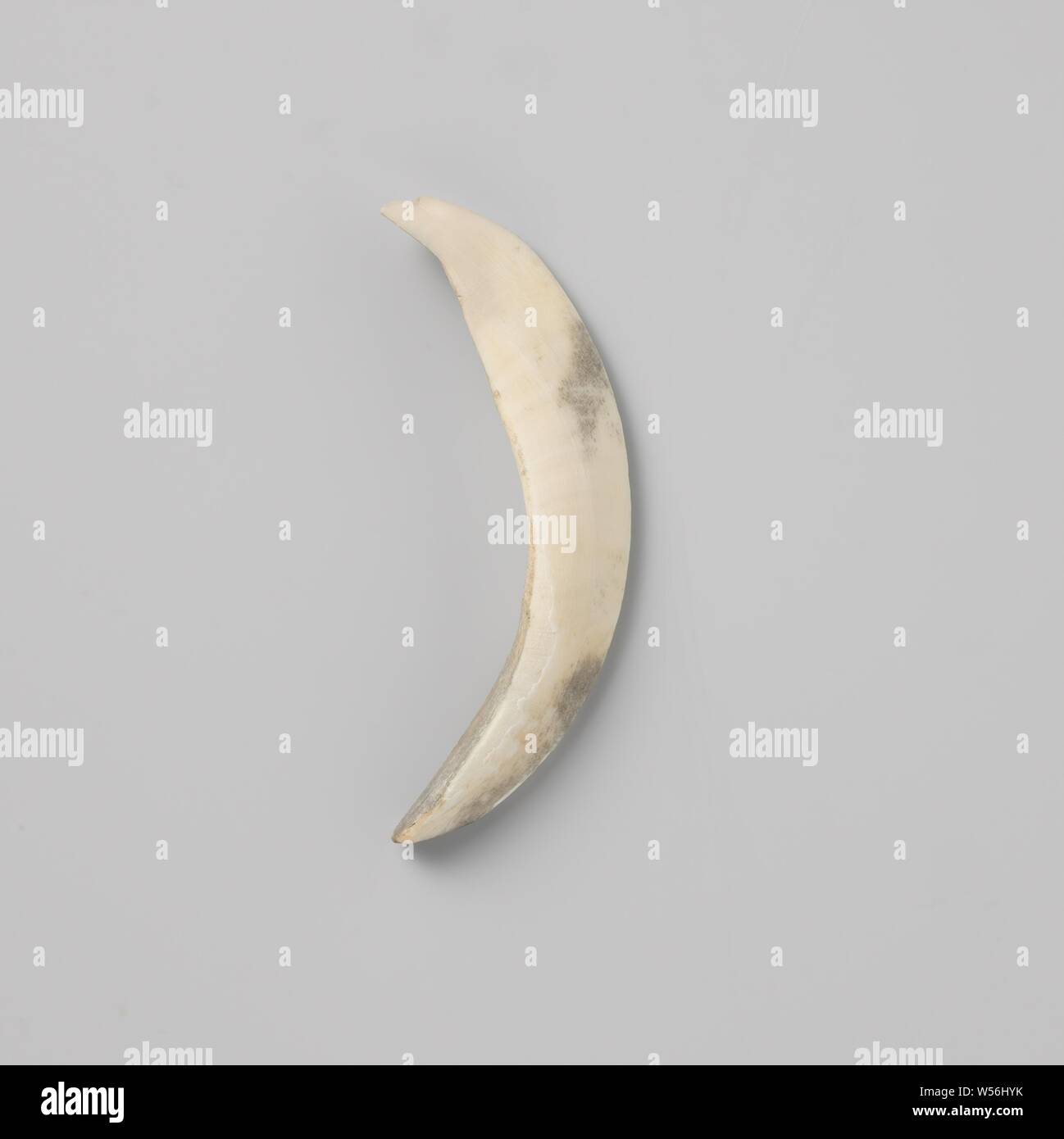 Comma Tooth Tooth Discoloration High Resolution Stock Photography and Images - Alamy