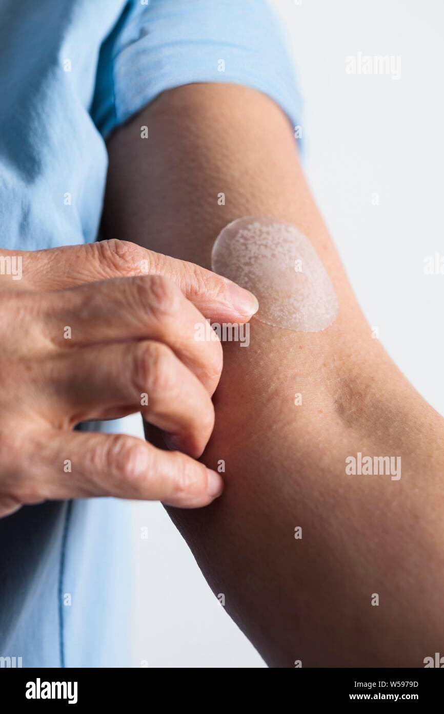 Woman applying a hormone replacement therapy (HRT) patch to her arm. This transdermal patch slowly administers the hormone oestrogen into the bloodstream. Oestrogen replacement therapy is typically given to relieve menopausal symptoms in women. Stock Photo