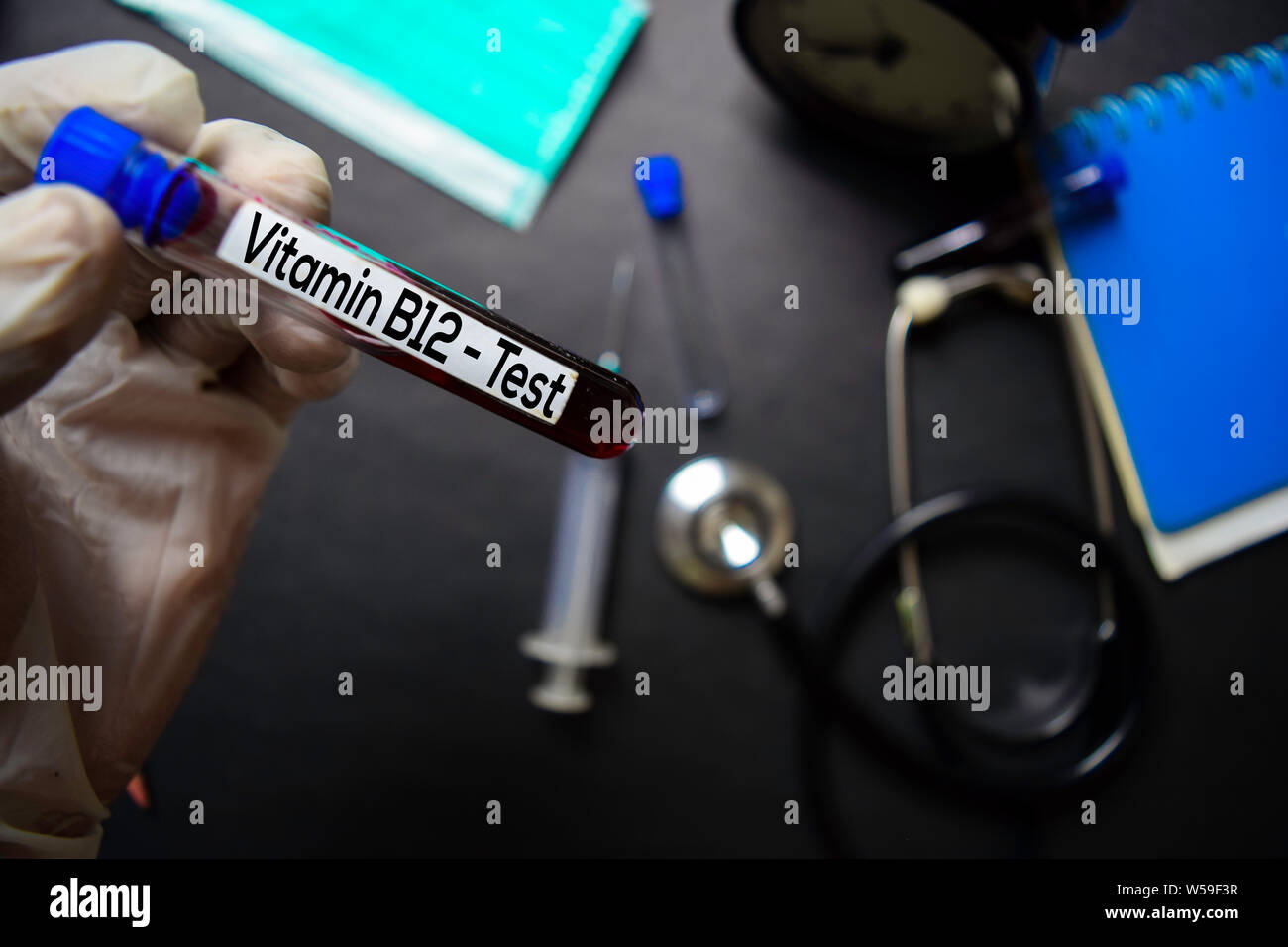 Vitamin B12 Test with blood sample. Top view isolated on black