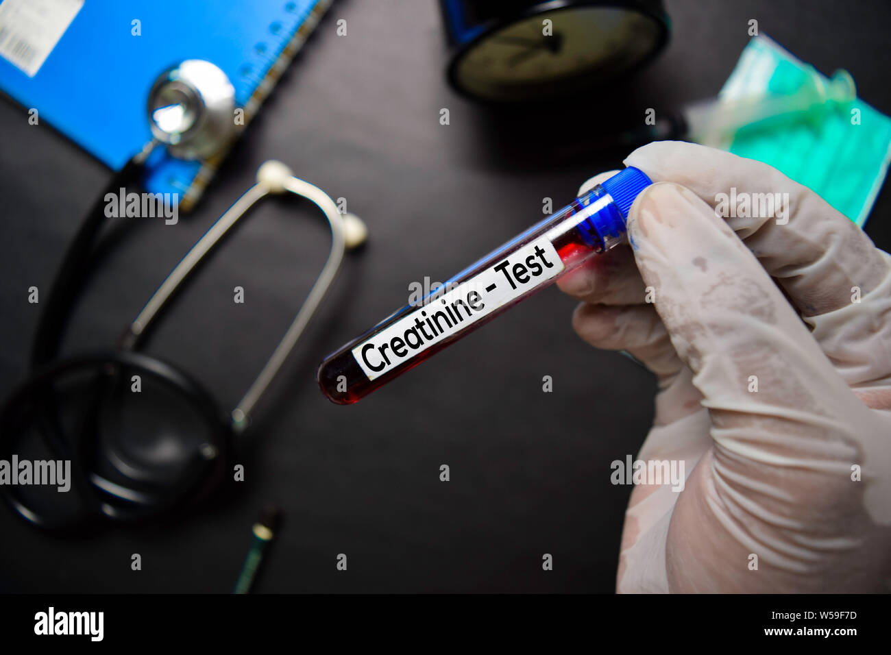 Creatinine Test with blood sample. Top view isolated on black