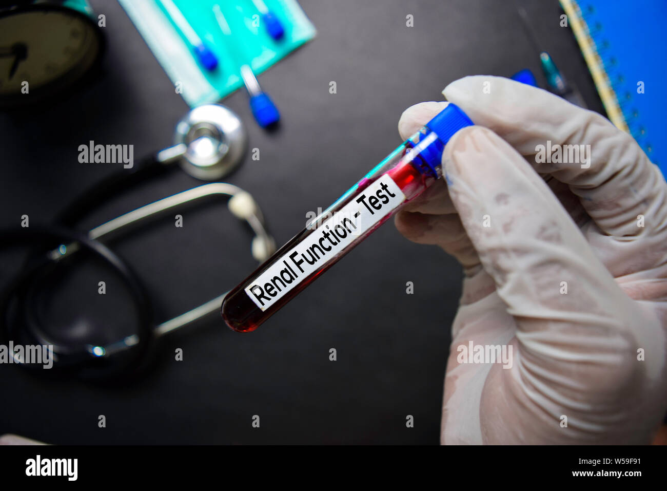 Renal Function Test with blood sample. Top view isolated on black