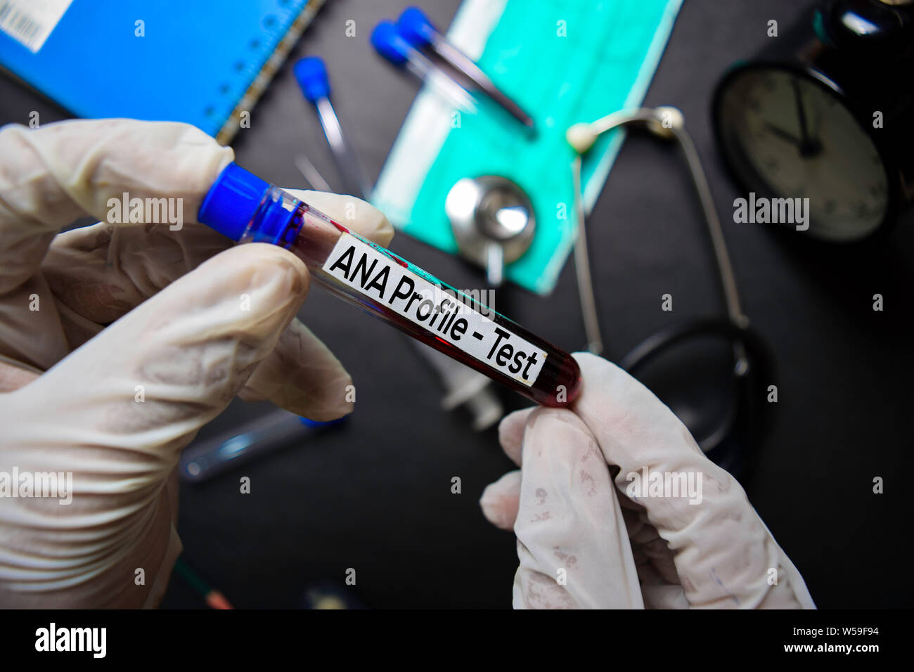 ANA Profile Test with blood sample. Top view isolated on black