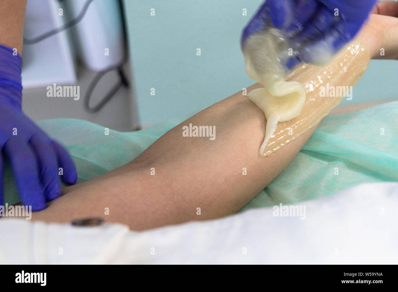 Master Sugaring Produces Hair Removal Procedure Natural Procedure