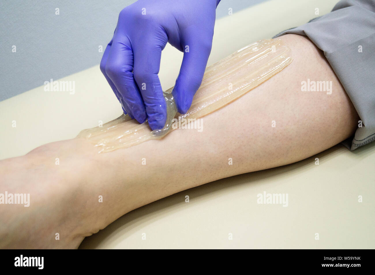 Master Sugaring Produces Hair Removal Procedure Natural Procedure