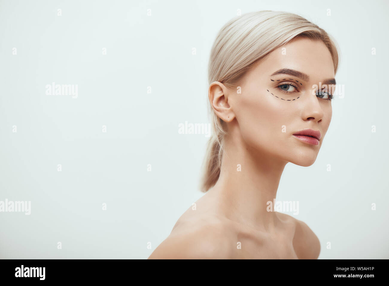 Perfection. Beautiful and young blonde woman with black surgical lines on eyelids and under eyes looking at camera. Beauty concept. Facelift. Plastic surgery Stock Photo