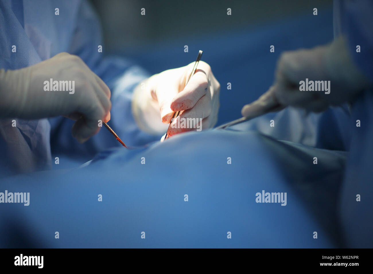 The doctor at work. During a surgical operation Stock Photo Alamy