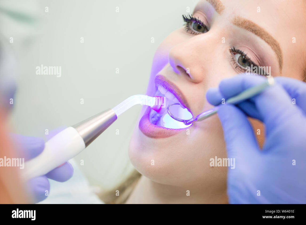 Dentist doing procedure with dental curing UV light in clinic Stock