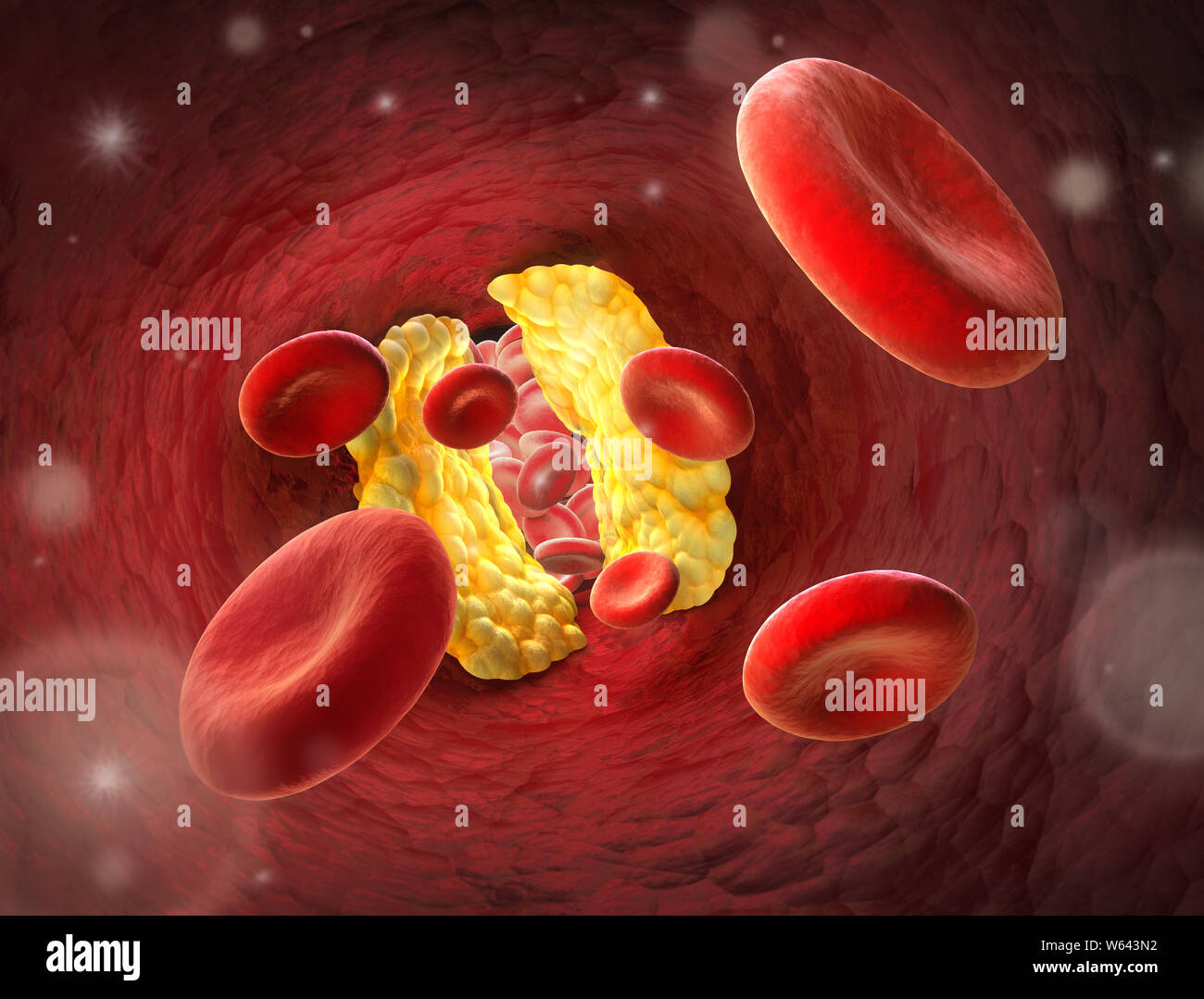 Red blood cells - narrowing inside a blood vessel - Erythrocyte 3D illustration Stock Photo