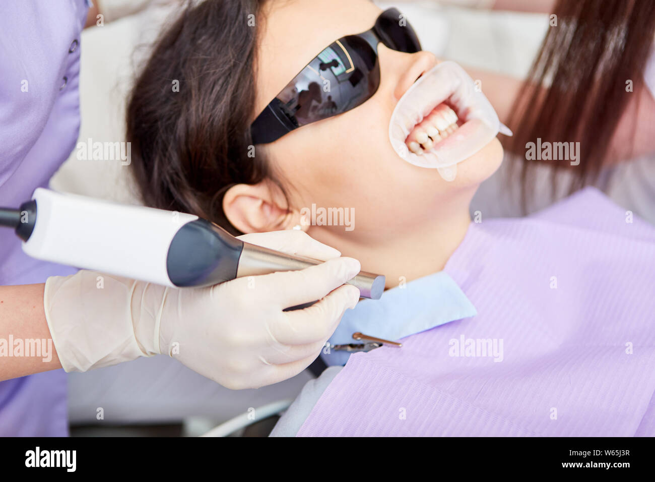 Patient at the professional cosmetic bleaching at the dentist in the dental office Stock Photo