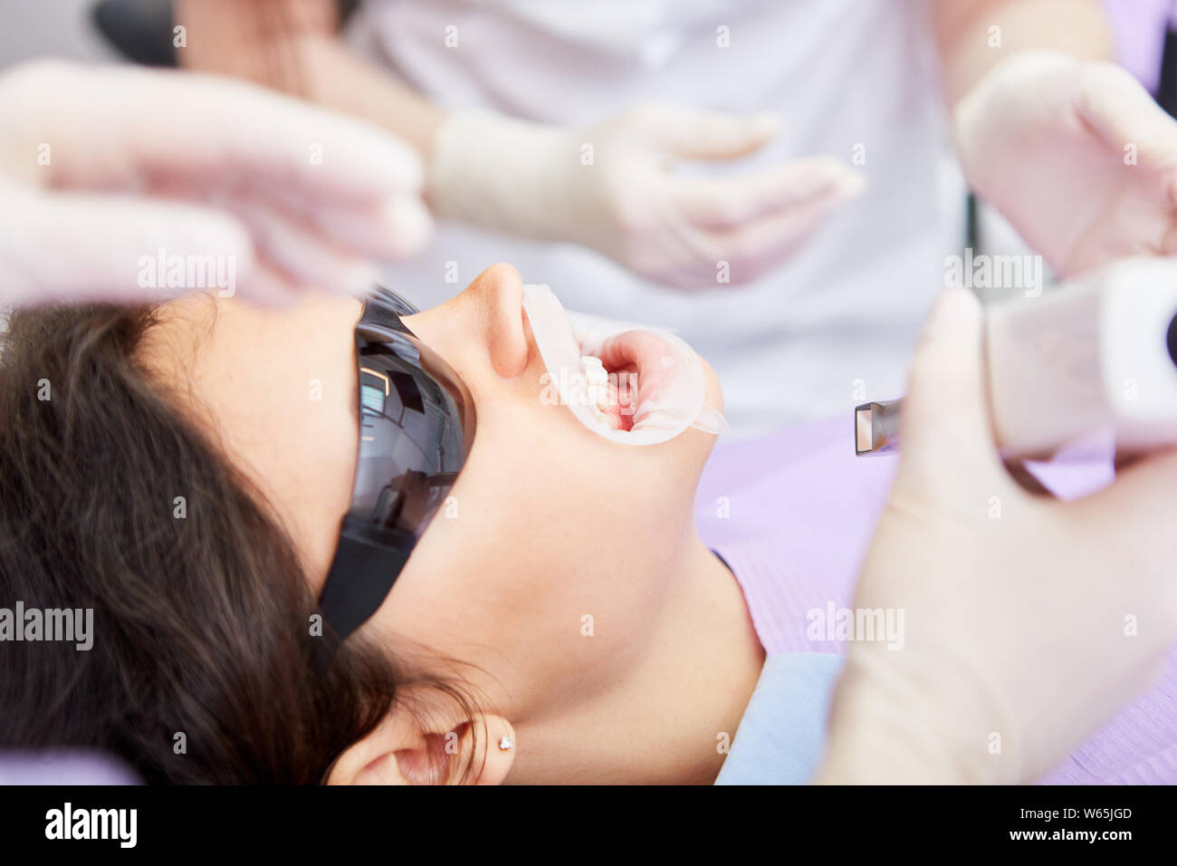 Patient with protective mask on her mouth at the dentist's for professional teeth whitening Stock Photo