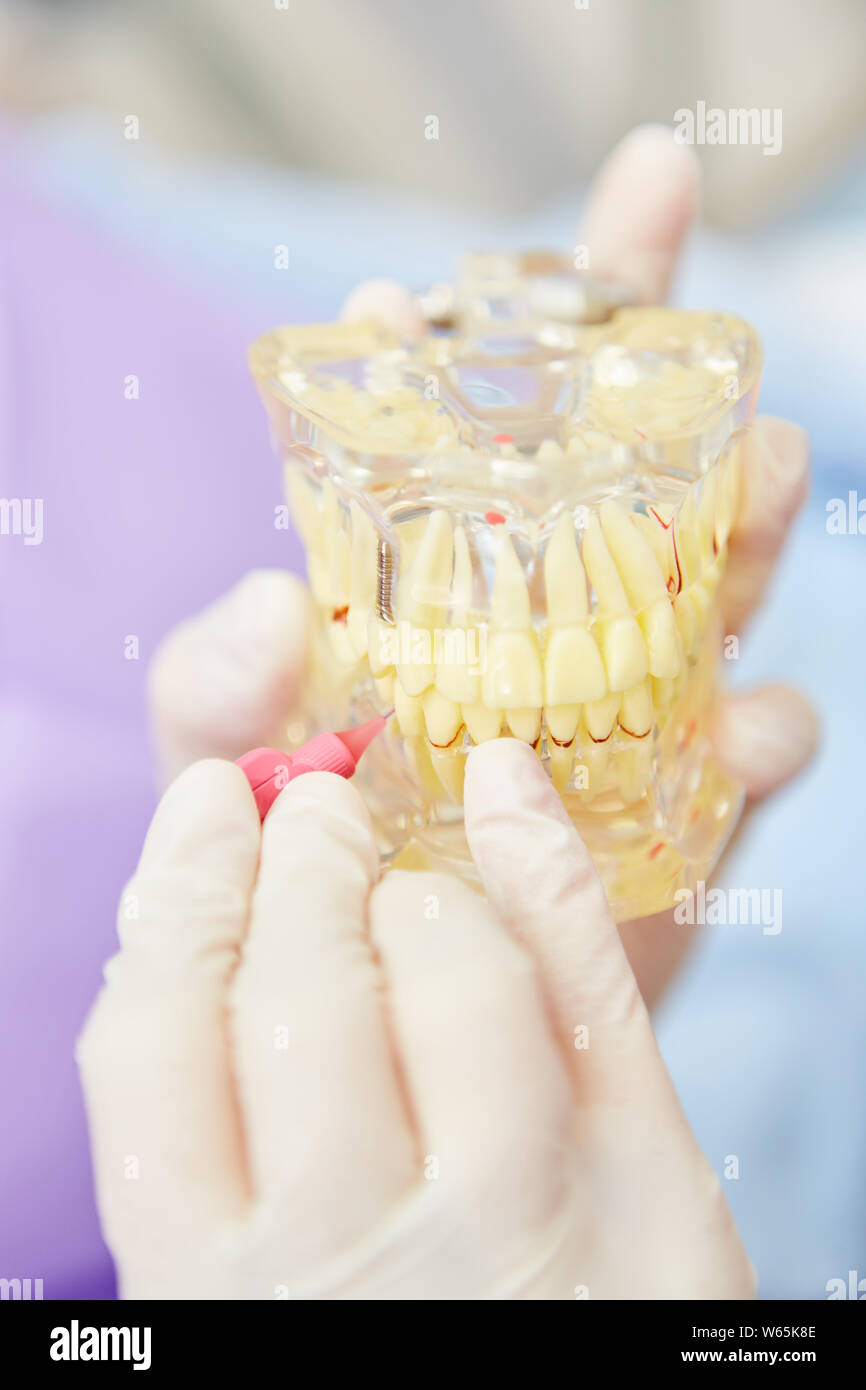 ZFA brushes the interdental spaces on a denture model with an interdental brush Stock Photo Alamy