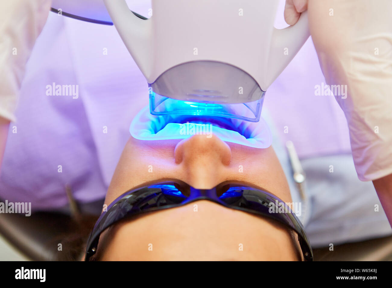Blue LED light is used when whitening the dentist Stock Photo