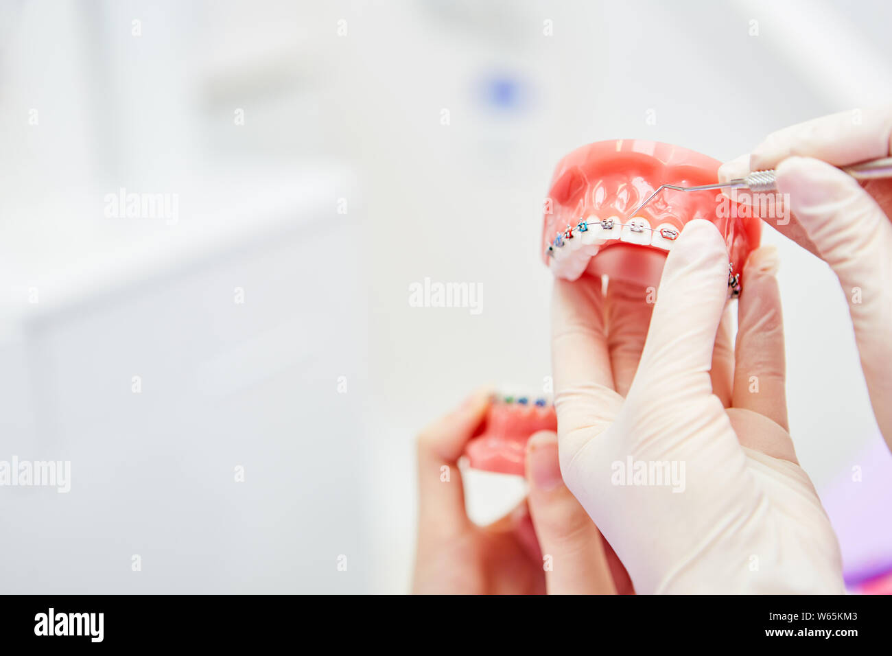 Dentist shows braces or dental brace on a denture model in a dental ...