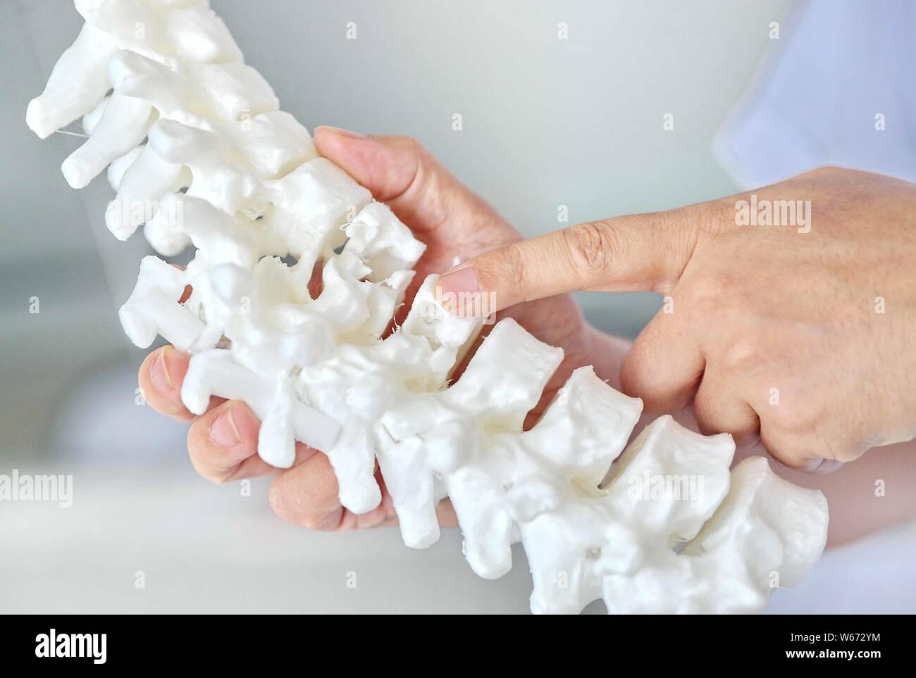 A doctor shows a 3D-printed model used for thoracic orthopedic surgery at First Hospital of Qinhuangdao in Qinhuangdao city, east China's Hebei provin Stock Photo