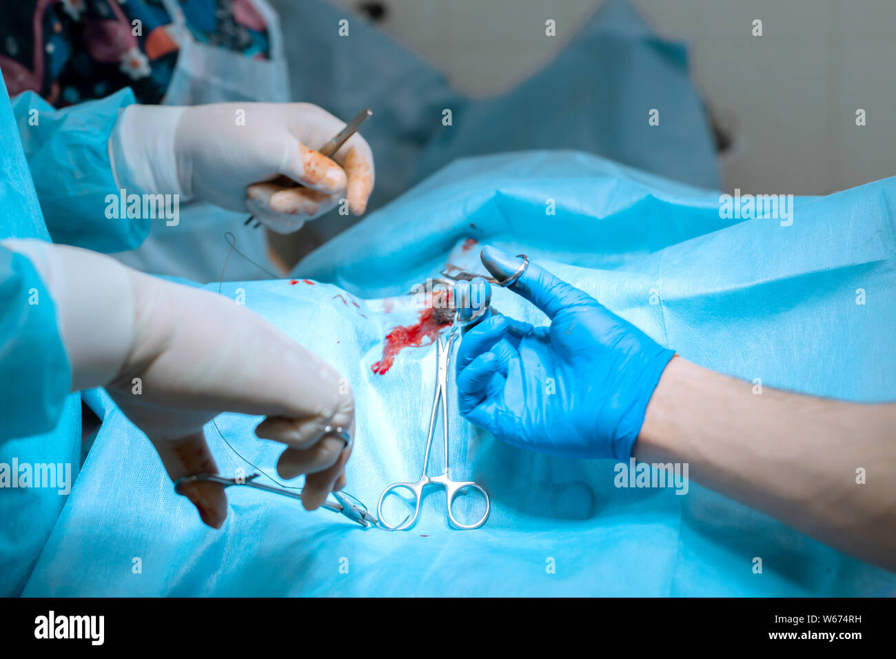 A male surgeon in a mask operates in a operating room with an assistant ...
