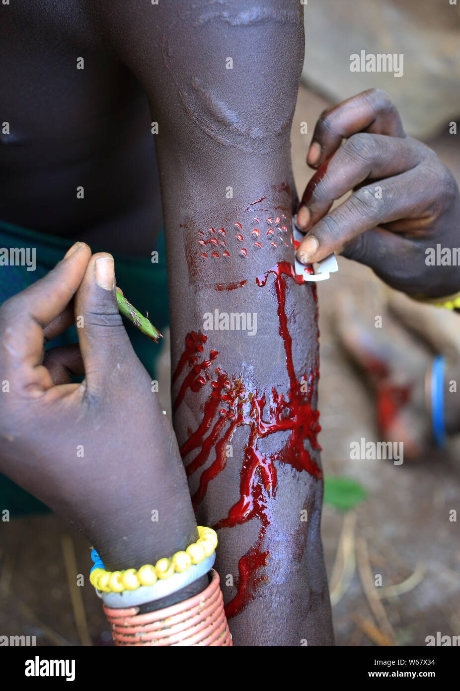 Scarification with a razor blade, Suri tribe, Ethiopia Stock Photo