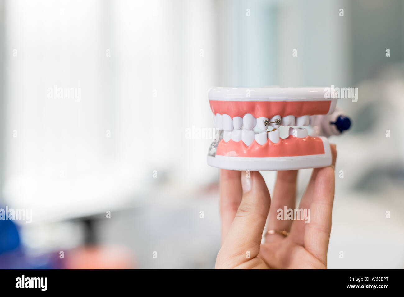 Model of human jaw with wire braces attached. Dental and orthodontic