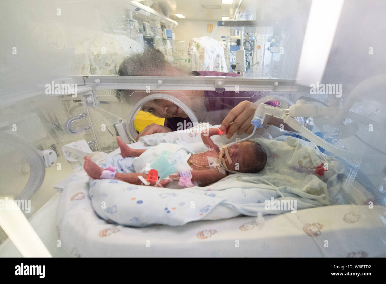In This Undated Photo A Doctor Examines The Premature Baby Named Chen Yuanmeng Born At 24 Weeks Inside An Incubator In The Shanxi Women Health Center Stock Photo Alamy