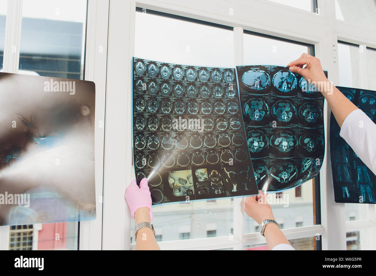 Professional medical team examining patient's medical records and xray