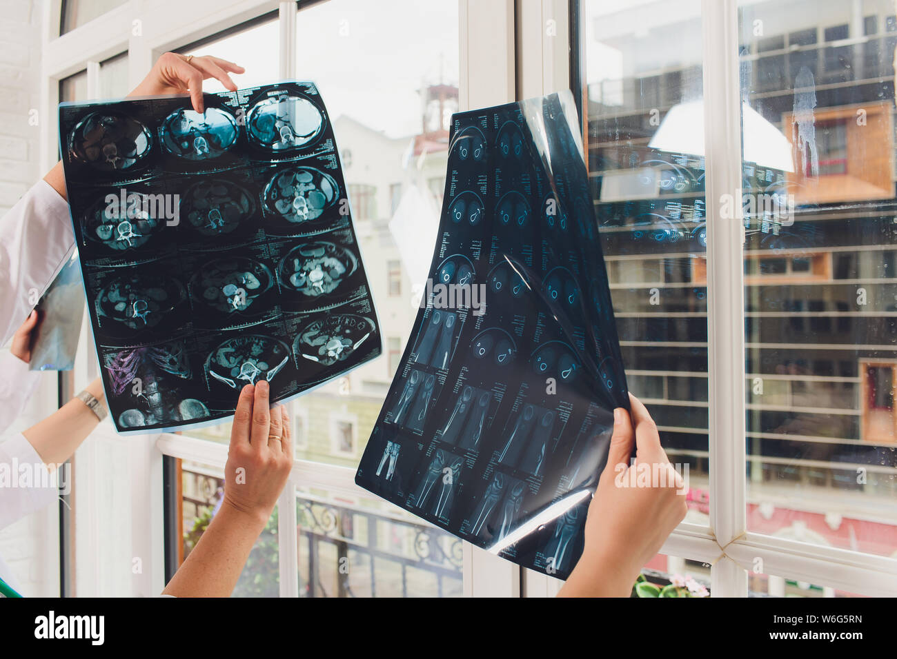 Professional medical team examining patient's medical records and xray