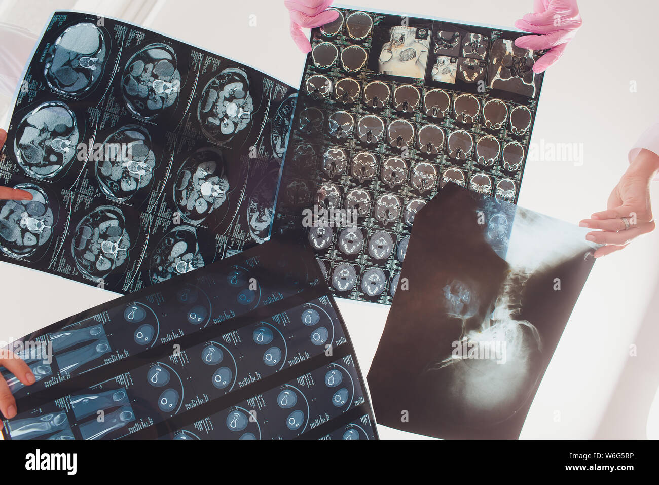 Professional medical team examining patient's medical records and xray