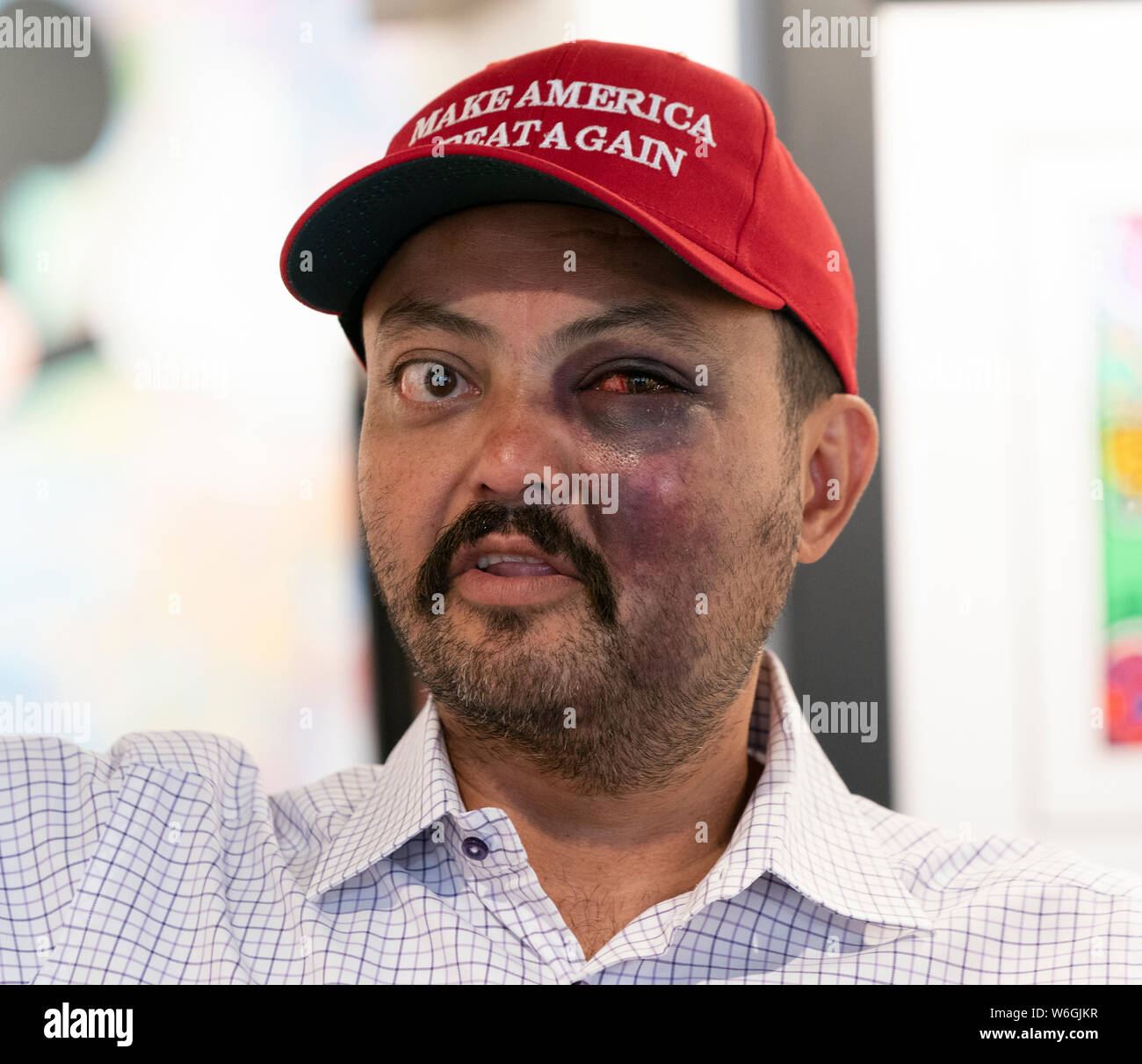 New York, NY - August 1, 2019: Jahangir Turan speaks at press conference after being beaten for wearing MAGA hat on the street of New York City by 15 teenagers at David Parker Gallery Stock Photo