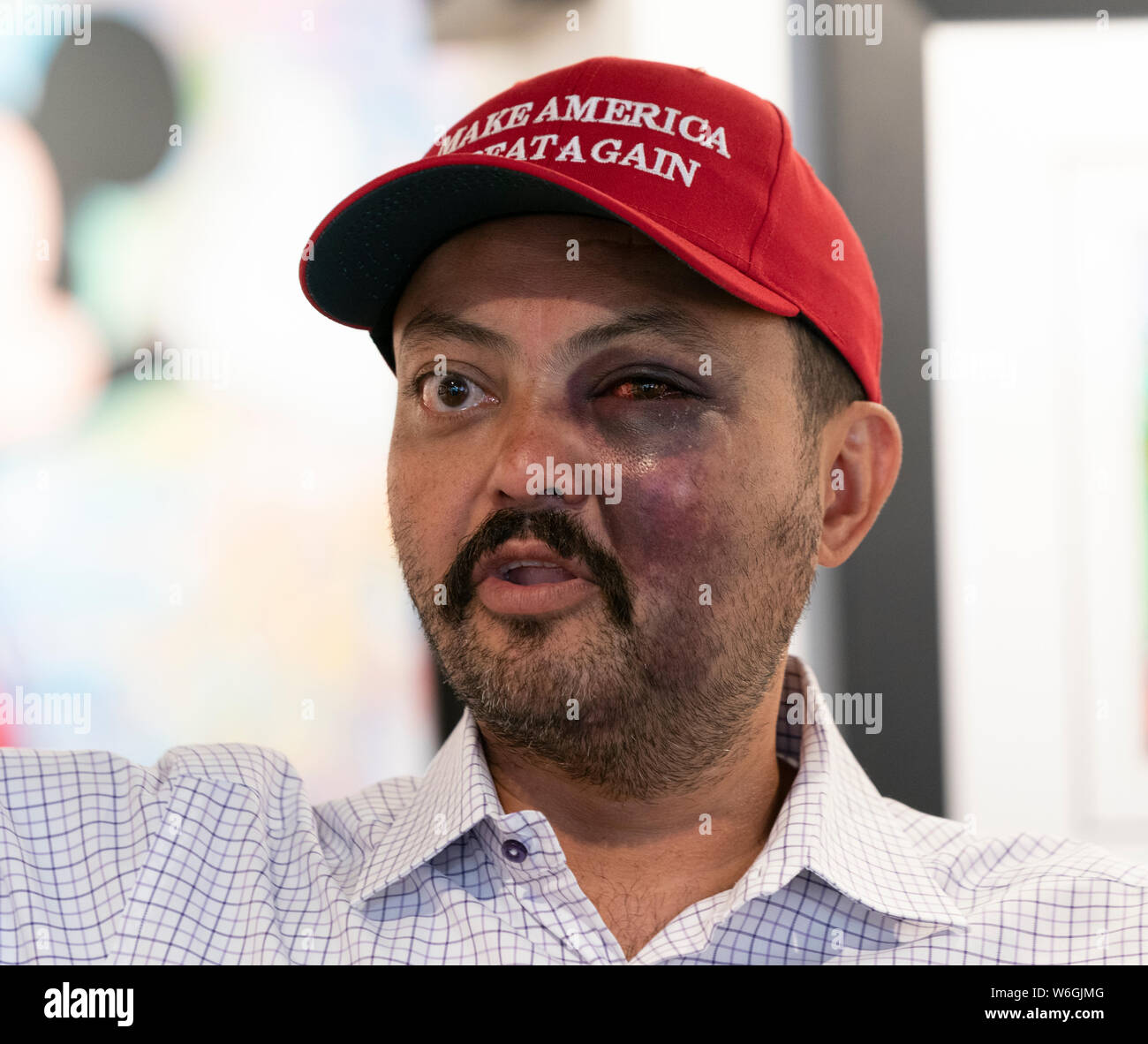 New York, NY - August 1, 2019: Jahangir Turan speaks at press conference after being beaten for wearing MAGA hat on the street of New York City by 15 teenagers at David Parker Gallery Stock Photo
