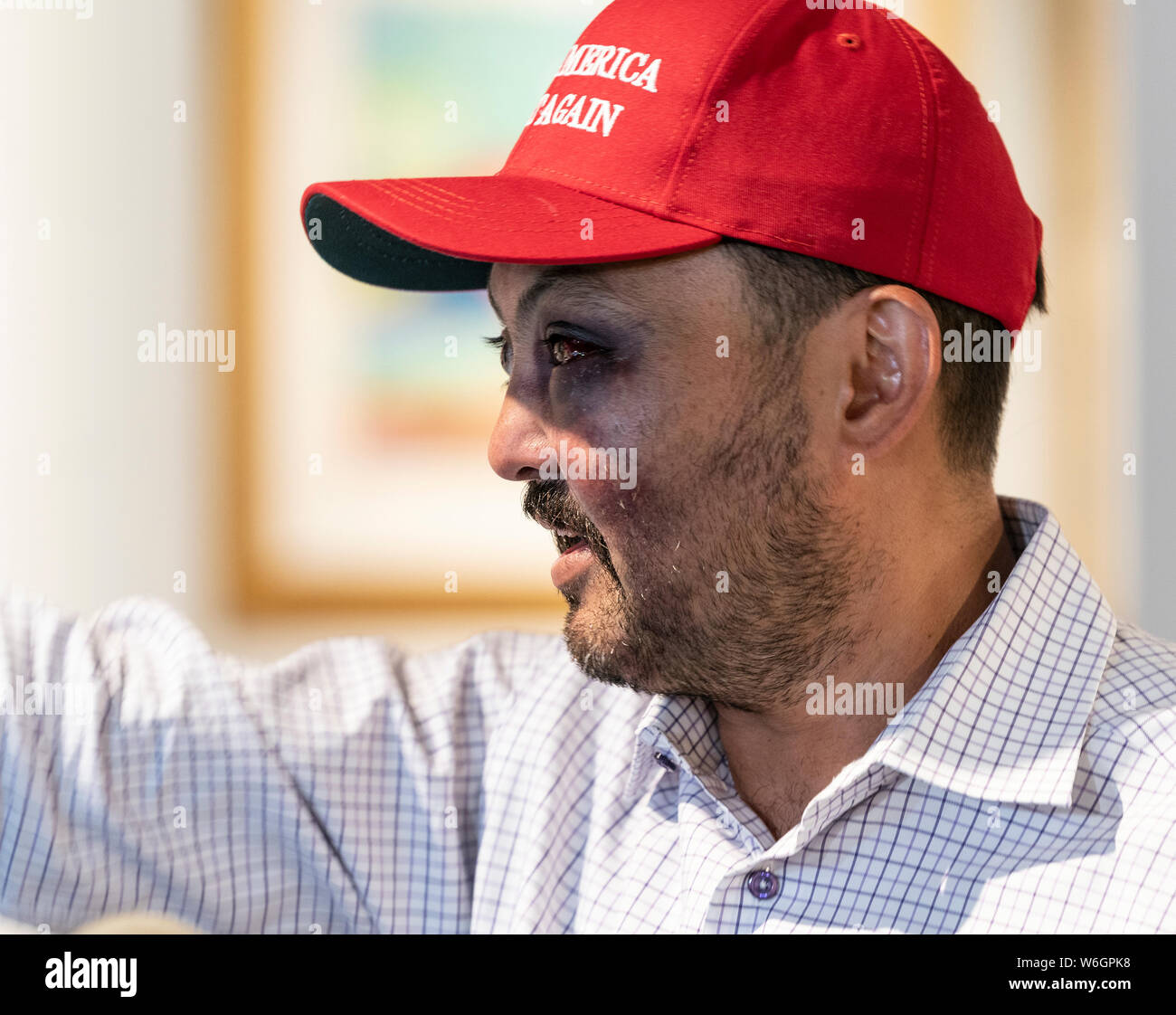 New York, United States. 01st Aug, 2019. Jahangir Turan speaks at press conference after being beaten for wearing MAGA hat on the street of New York City by 15 teenagers at David Parker Gallery. Credit: Lev Radin/Pacific Press/Alamy Live News Stock Photo