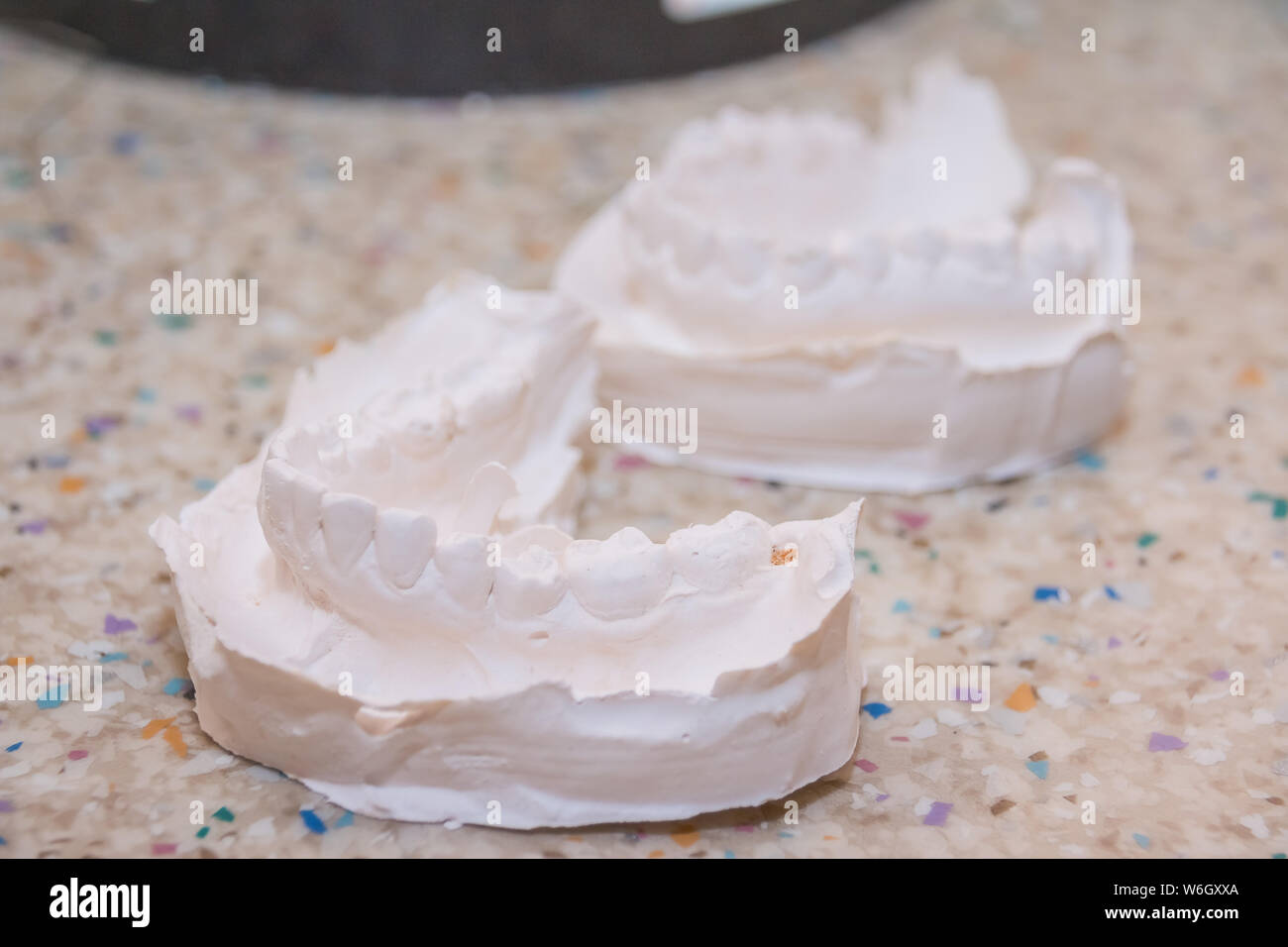 Plaster impression of teeth. Dental plaster mold. Dental mold showing