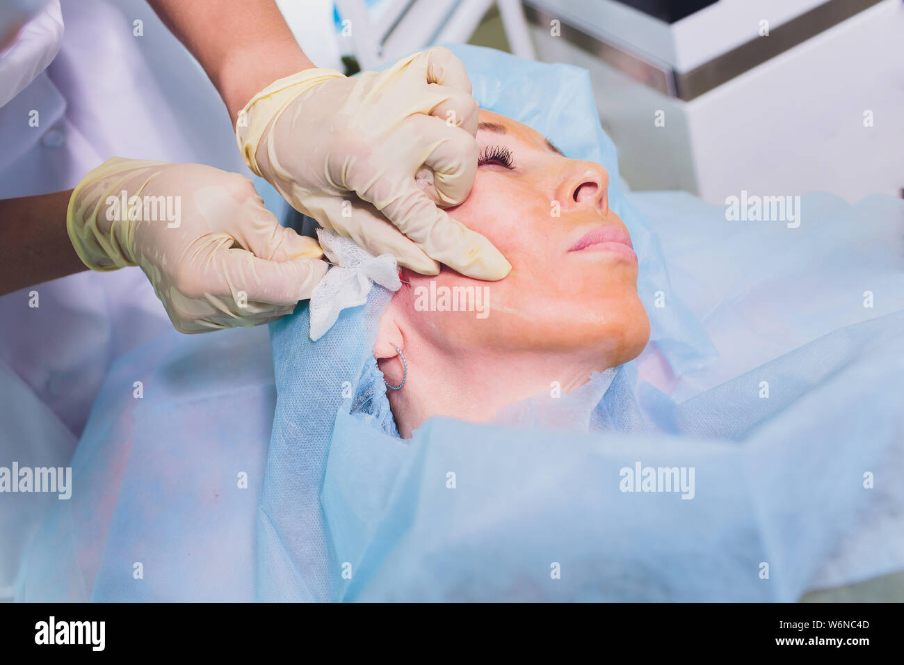 Aged woman doing mesothreads and Thread Lifting, Cosmetology. Cosmetic